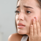 Girls with lashes falling out and onto her cheek